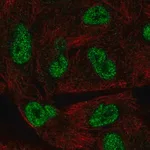 Merck Anti-HORMAD1 antibody produced in rabbit