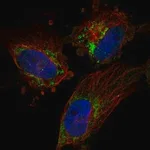 Merck Anti-TFB2M antibody produced in rabbit