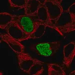 Merck Anti-DYRK1B antibody produced in rabbit
