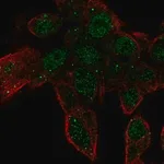 Merck Anti-ZNF232 antibody produced in rabbit
