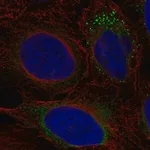 Merck Anti-ADAMTS9 antibody produced in rabbit