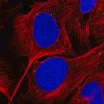 Merck Anti-GRK4 antibody produced in rabbit