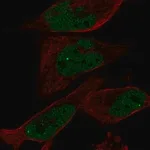 Merck Anti-EYA1 antibody produced in rabbit