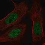Merck Anti-BAP1 antibody produced in rabbit
