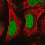 Merck Anti-CENPQ antibody produced in rabbit