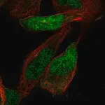 Merck Anti-ZNF518A antibody produced in rabbit