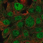 Merck Anti-SLC2A2 antibody produced in rabbit