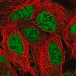 Merck Anti-TAF11 antibody produced in rabbit