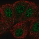 Merck Anti-ERCC8 antibody produced in rabbit