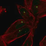 Merck Anti-E2F1 antibody produced in rabbit