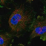 Merck Anti-TGS1 antibody produced in rabbit