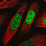 Merck Anti-EGR1 antibody produced in rabbit