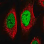 Merck Anti-EGR1 antibody produced in rabbit
