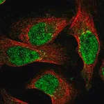Merck Anti-NUDT18 antibody produced in rabbit