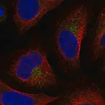 Merck Anti-UFD1L antibody produced in rabbit