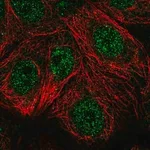 Merck Anti-TSPAN17 antibody produced in rabbit