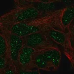 Merck Anti-TRMT11 antibody produced in rabbit