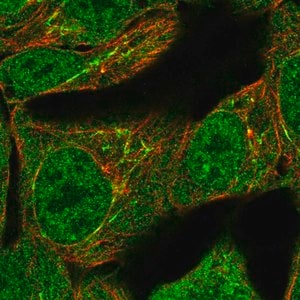 Merck Anti-TNFAIP2 antibody produced in rabbit