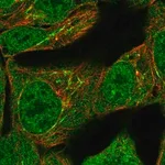 Merck Anti-TNFAIP2 antibody produced in rabbit