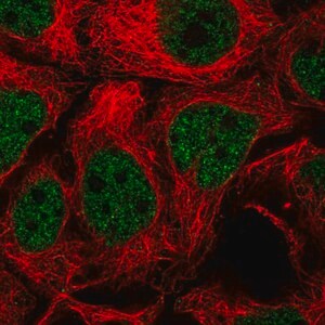 Merck Anti-TGIF2 antibody produced in rabbit
