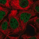 Merck Anti-TGIF2 antibody produced in rabbit