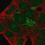 Merck Anti-DHRS2 antibody produced in rabbit