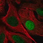 Merck Anti-UPP1 antibody produced in rabbit