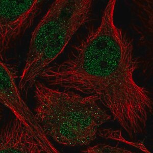 Merck Anti-ASF1B antibody produced in rabbit