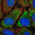 Merck Anti-YTHDF2 antibody produced in rabbit