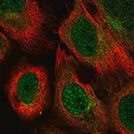 Merck Anti-UBQLN1 antibody produced in rabbit