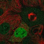 Merck Anti-CCND2 antibody produced in rabbit