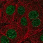 Merck Anti-TTC5 antibody produced in rabbit