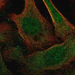 Merck Anti-DCAF6 antibody produced in rabbit