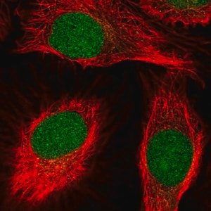 Merck Anti-SCNM1 antibody produced in rabbit