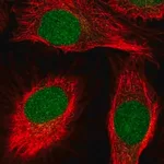 Merck Anti-SCNM1 antibody produced in rabbit
