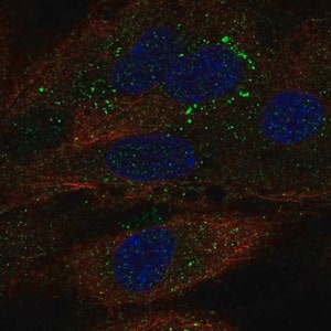 Merck Anti-TDRD10 antibody produced in rabbit