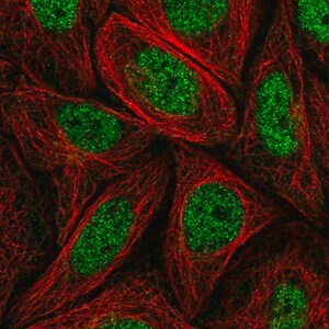 Merck Anti-MED14 antibody produced in rabbit
