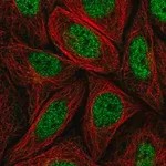 Merck Anti-MED14 antibody produced in rabbit