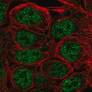 Merck Anti-S100A5 antibody produced in rabbit