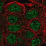 Merck Anti-S100A5 antibody produced in rabbit