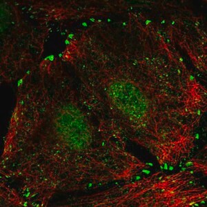 Merck Anti-LIMD1 antibody produced in rabbit
