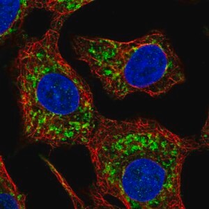 Merck Anti-HKDC1 antibody produced in rabbit