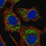 Merck Anti-HKDC1 antibody produced in rabbit