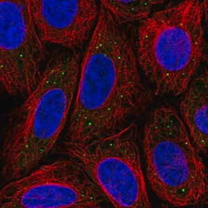 Merck Anti-MED17 antibody produced in rabbit