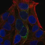 Merck Anti-GCKR antibody produced in rabbit