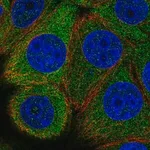 Merck Anti-EIF2B5 antibody produced in rabbit