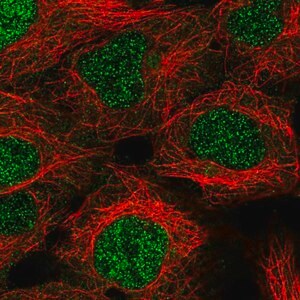 Merck Anti-KDELC1 antibody produced in rabbit