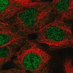 Merck Anti-KDELC1 antibody produced in rabbit