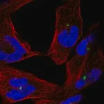 Merck Anti-CEP290 antibody produced in rabbit