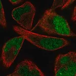 Merck Anti-PPME1 antibody produced in rabbit